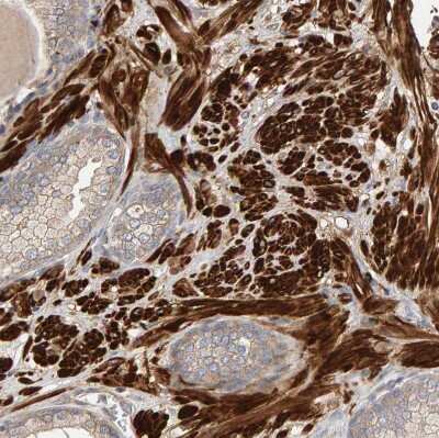 Immunohistochemistry-Paraffin: DORFIN Antibody [NBP1-87989]