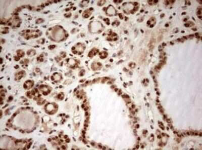 Immunohistochemistry: DOT1L Antibody (OTI6E7) [NBP2-46474]