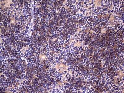 Immunohistochemistry: DOT1L Antibody (OTI1D8) - Azide and BSA Free [NBP2-72297]