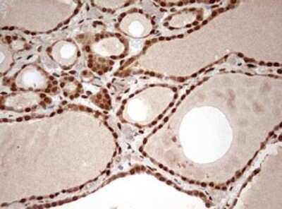 Immunohistochemistry: DOT1L Antibody (OTI6E7) - Azide and BSA Free [NBP2-72298]