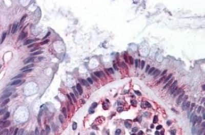 Immunohistochemistry-Paraffin: DPEP1 Antibody [NBP3-14300]