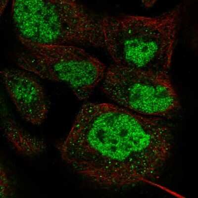 Immunocytochemistry/ Immunofluorescence: DPF2 Antibody [NBP1-87138]