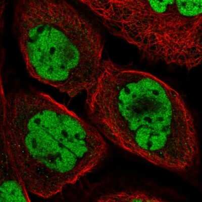 Immunocytochemistry/ Immunofluorescence: DPF2 Antibody [NBP2-58389]