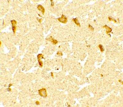 Immunohistochemistry: DPF3 Antibody - BSA Free [NBP2-82087]