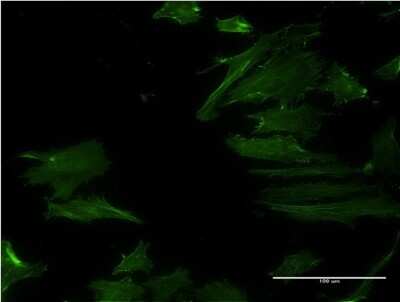 Immunocytochemistry/ Immunofluorescence: DPH2 Antibody (3F7) [H00001802-M07]