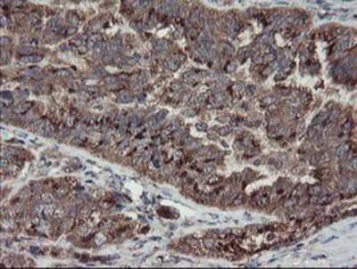 Immunohistochemistry-Paraffin: DPH2 Antibody (OTI4E7) [NBP2-03732]