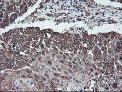 Immunohistochemistry-Paraffin: DPH2 Antibody (OTI4E7) [NBP2-03732]