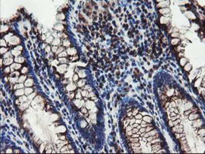 Immunohistochemistry-Paraffin: DPH2 Antibody (OTI4E7) [NBP2-03732]