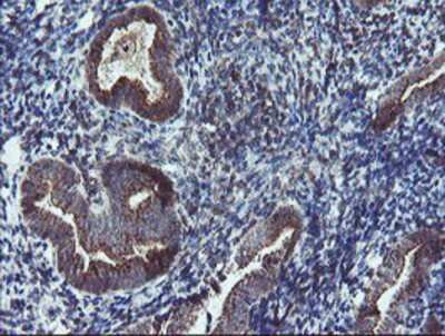 Immunohistochemistry-Paraffin: DPH2 Antibody (OTI4E7) [NBP2-03732]