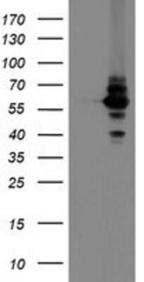 Western Blot: DPH2 Antibody (OTI4E7) [NBP2-03732]
