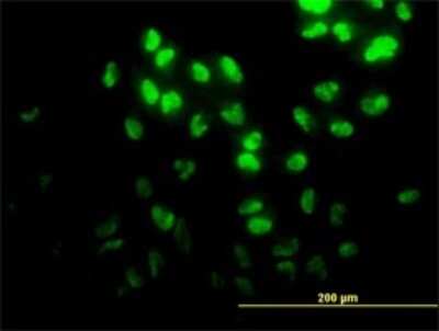 Immunocytochemistry/ Immunofluorescence: DPH2 Antibody (5B10) [H00001802-M02]