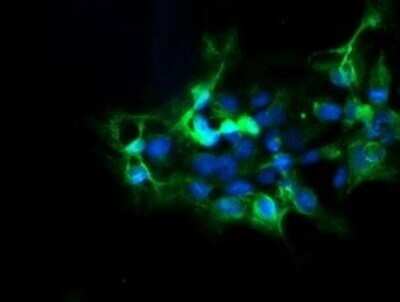 Immunocytochemistry/ Immunofluorescence: DPH2 Antibody (OTI3A12) - Azide and BSA Free [NBP2-70587]