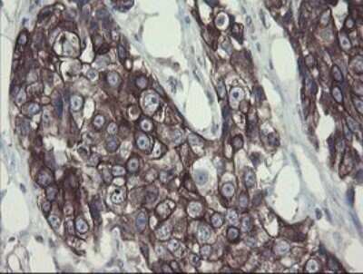 Immunohistochemistry: DPH2 Antibody (OTI3A12) - Azide and BSA Free [NBP2-70587]