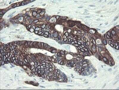 Immunohistochemistry: DPH2 Antibody (OTI3A12) - Azide and BSA Free [NBP2-70587]