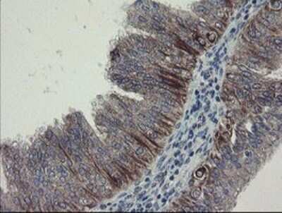 Immunohistochemistry: DPH2 Antibody (OTI3A12) - Azide and BSA Free [NBP2-70587]