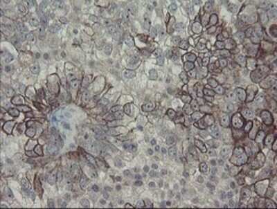 Immunohistochemistry: DPH2 Antibody (OTI3A12) - Azide and BSA Free [NBP2-70587]