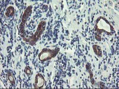 Immunohistochemistry: DPH2 Antibody (OTI3A12) - Azide and BSA Free [NBP2-70587]