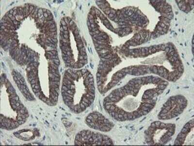 Immunohistochemistry: DPH2 Antibody (OTI3A12) - Azide and BSA Free [NBP2-70587]