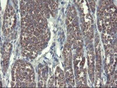 Immunohistochemistry: DPH2 Antibody (OTI3A12) - Azide and BSA Free [NBP2-70587]