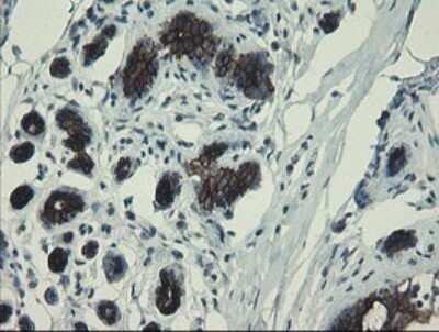 Immunohistochemistry: DPH2 Antibody (OTI3A12) - Azide and BSA Free [NBP2-70587]
