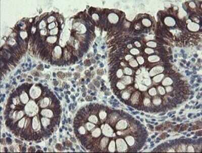 Immunohistochemistry: DPH2 Antibody (OTI3A12) - Azide and BSA Free [NBP2-70587]