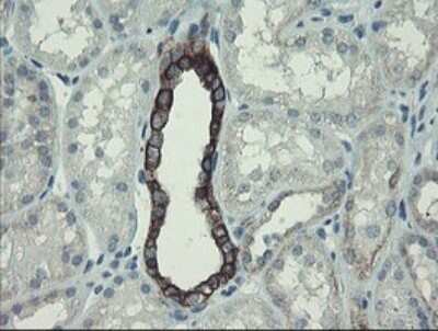 Immunohistochemistry: DPH2 Antibody (OTI3A12) - Azide and BSA Free [NBP2-70587]
