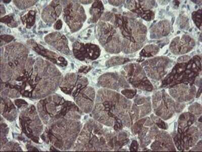 Immunohistochemistry: DPH2 Antibody (OTI3A12) - Azide and BSA Free [NBP2-70587]