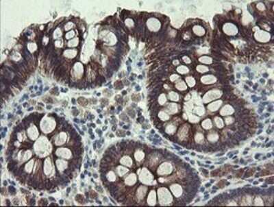 Immunohistochemistry: DPH2 Antibody (OTI3A12) [NBP2-46475]