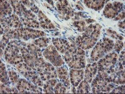 Immunohistochemistry: DPH2 Antibody (OTI4E7) - Azide and BSA Free [NBP2-70585]