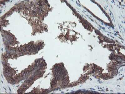 Immunohistochemistry: DPH2 Antibody (OTI4E7) - Azide and BSA Free [NBP2-70585]