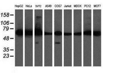 Western Blot: DPH2 Antibody (OTI4E7)Azide and BSA Free [NBP2-70585]