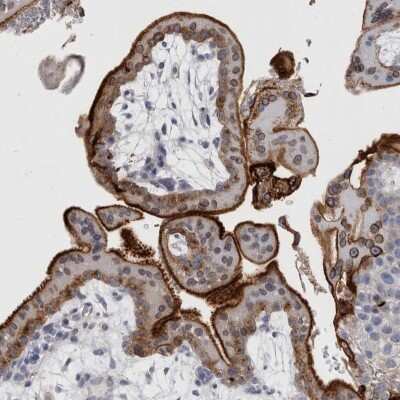 Immunohistochemistry-Paraffin: DPH4 Antibody [NBP1-87968]
