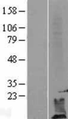 Western Blot: DPM2 Overexpression Lysate [NBL1-09993]