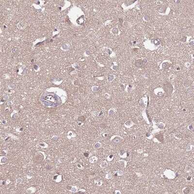Immunohistochemistry-Paraffin: DPP10 Antibody [NBP2-13936]
