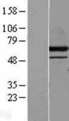 Western Blot: DPPII/QPP/DPP7 Overexpression Lysate [NBL1-09998]