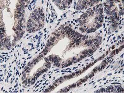 Immunohistochemistry-Paraffin: DPP3 Antibody (OTI2D9) [NBP2-01007]
