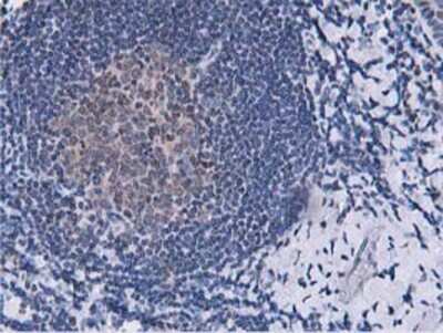 Immunohistochemistry-Paraffin: DPP3 Antibody (OTI2D9) [NBP2-01007]
