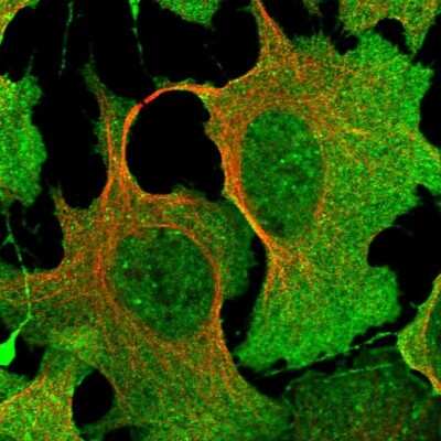 Immunocytochemistry/ Immunofluorescence: DPP3 Antibody [NBP1-89493]