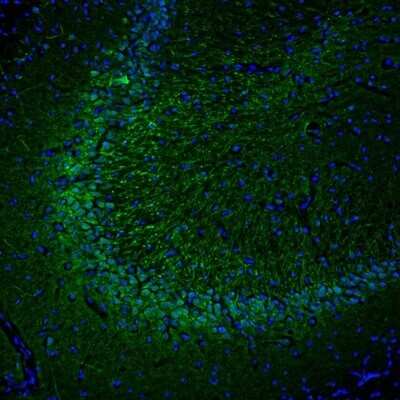 Immunohistochemistry: DPP6 Antibody [NBP2-47481]