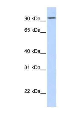 Western Blot: DPP6 Antibody [NBP1-59427]