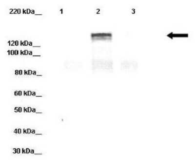 Western Blot: DPP6 Antibody [NBP1-59925]