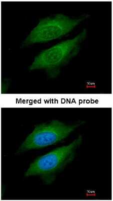 Immunocytochemistry/ Immunofluorescence: DPP8 Antibody [NBP1-31256]