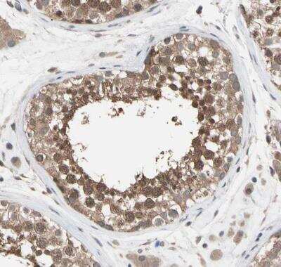 Immunohistochemistry-Paraffin: DPP8 Antibody [NBP1-84993]