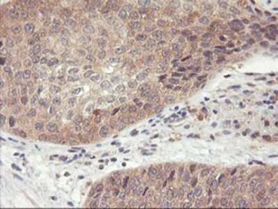 Immunohistochemistry: DPP9 Antibody (OTI2E3) - Azide and BSA Free [NBP2-72318]