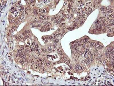 Immunohistochemistry: DPP9 Antibody (OTI2E3) - Azide and BSA Free [NBP2-72318]