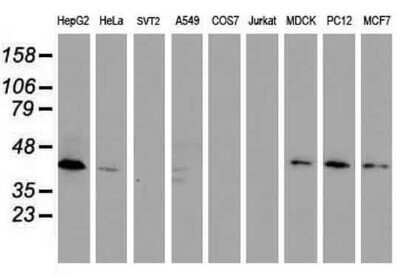 Western Blot: DPPA2 Antibody (OTI1G10) [NBP2-45680]