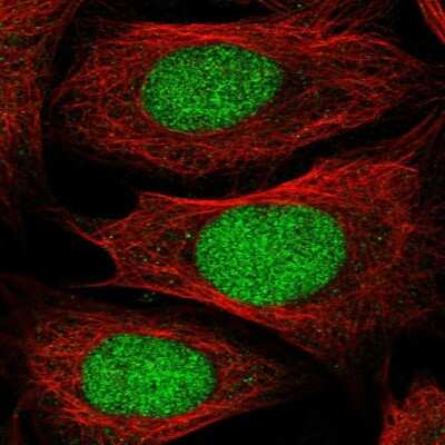 Immunocytochemistry/ Immunofluorescence: DPPA2 Antibody [NBP1-85426]