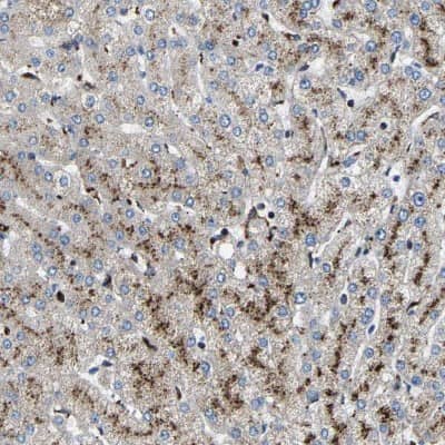 Immunohistochemistry-Paraffin: DPPII/QPP/DPP7 Antibody [NBP1-84986]