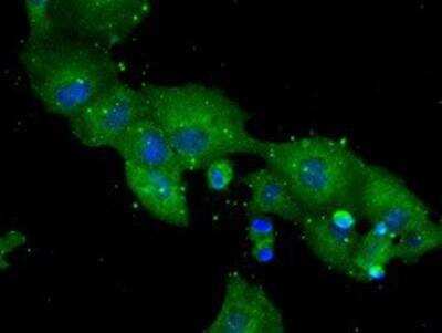 Immunocytochemistry/ Immunofluorescence: DPPIV/CD26 Antibody (OTI11D7) [NBP2-02154]