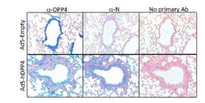 Immunohistochemistry: DPPIV/CD26 Antibody (OTI11D7) [NBP2-02154]